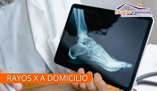 HL Estudios a Domicilio - 10% de descuento en Rayos X