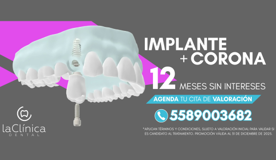 LA CLÍNICA DENTAL JARDINES DEL PEDREGAL - Implante + Corona a 12 meses sin intereses